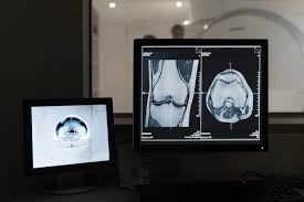 ai in radiology