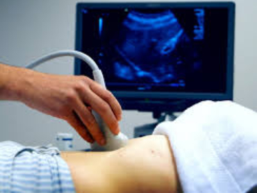 Ultrasound Explained: Safe & Radiation-Free Imaging for Diagnosis